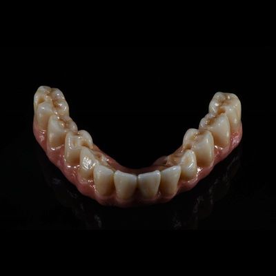 chất lượng  Fixed Restorations Full Arch Zirconia Implant Bridge Denture Teeth nhà máy sản xuất