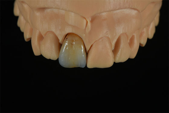 chất lượng  Affordable Zirconia Crowns with Custom Color Staining - China Dental Lab nhà máy sản xuất